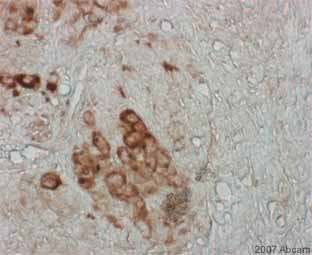ab34771 staining mouse subcutaneous tissue that had been injected with a mixture of cells including mouse embryonic stem cells previously transduced with a retrovirus that expresses RFP.The sample was fixed with paraformaldehyde and a heat mediated antigen retreival step using Sodium citrate 10 mM (pH 6.0) was performed.  1.5% serum was used as the blocking agent for 30 minutes at 20°C.  The primary antibody was diluted 1/400 in 1xPBS with 1.5% normal serum and incubated for 1 hour at 20°C. A Biotinylated goat anti-rabbit IgG (H+L) antibody was used as the secondary.See Abreview