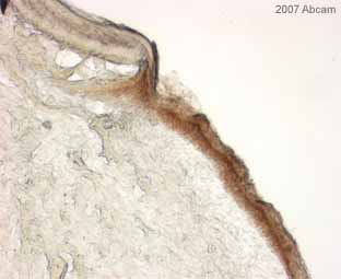 ab34771 staining mouse epidermis that had been damaged and injected with a mixture of cells inlcuding mouse embryonic stem cells previously transduced with a retrovirus that expresses RFP.  The color is developed with DAB.The sample was acetone fixed and incubated with ab34771 diluted 1/400 for 1 hour at 20°C. A Biotinylated goat anti-rabbit IgG (H+L) antibody was used as the secondary.See Abreview