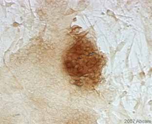 ICC image of ab34771 staining murine embryonic stem cells, transduced with RFP gene, cultured over mouse embryonic fibroblast.  The cells were PFA fixed and blocked with 1.5% serum for 45 minutes at 20°C.  The primary antibody was diluted 1/1600 and incubated for 1 hour and 15 minutes at 20°C. A biotinylated goat anti-rabbit IgG (H+L) was used as the secondary.See Abreview