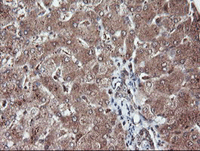 ab128090 at 1/150 dilution staining RFPL3 in Paraffin-embedded Human Liver tissue by Immunohistochemistry.