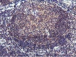 Immunohistochemical staining of paraffin-embedded Human tonsil using 1/150 ab119432.