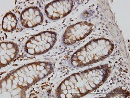 RGL1 antibody (ab57390) used in immunohistochemistry at 3ug/ml on formalin fixed and paraffin embedded human colon.