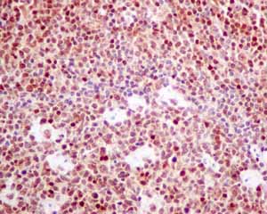 Immunohistochemical analysis of paraffin embedded Human normal tonsil tissue using ab154172 showing +ve staining.