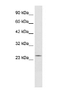 Anti-RGS13 antibody (ab28467) at 0.5 µg/ml