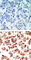 Immunohistochemical analysis of RGS19 in paraffin embedded, formalin fixed human liver tissue using an isotype control (top) and ab72085 (bottom) at 5µg/ml.