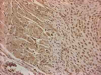ab36561 staining RGS2 in human heart tissue section by Immunohistochemistry (Formalin/PFA-fixed paraffin-embedded sections). Tissue underwent fixation in formaldehyde, heat mediated antigen retrieval in Citrate buffer pH 6.0 and blocking (5 minutes/peroxidase block then 10 minutes/protein block) for 15 minutes at 20°C. The primary antibody was diluted, 1/250 and incubated with sample for 45 minutes at 20°C. A HRP conjugated goat polyclonal to rabbit IgG was used undiluted as secondary.See Abreview
