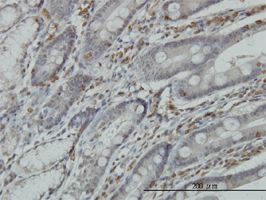 RGS3 antibody (ab57923) used in immunohistochemistry at 3ug/ml on formalin fixed and paraffin embedded human small Intestine.