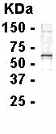 Anti-RGS4 antibody (ab14264) at 1/2000 dilutionSecondaryGoat anti-IgY-HRP at 1/1000 dilution
