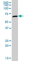 Anti-RGS6 antibody (ab88086) at 1 µg/ml + SJCRH30 cell lysate at 50 µgSecondaryGoat Anti-Mouse IgG (H&L)-HRP Conjugate at 1/2500 dilution