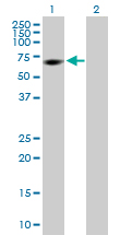 All lanes : Anti-RGS6 antibody (ab88086) at 1 µg/mlLane 1 : transfected 293T cell line lysateLane 2 : non transfected 293T cell line lysateLysates/proteins at 25 µg per lane.SecondaryGoat Anti-Mouse IgG (H&L)-HRP Conjugate at 1/5000 dilution
