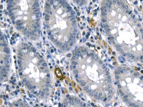 ab155094 showing +ve staining in Human normal colon.