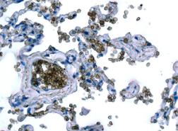 Immunohistochemical analysis of paraffin-embedded Human lung tissue labeling RHAG with ab155094 at 1/250 dilution.