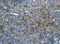 Immunohistochemical analysis of paraffin-embedded Human spleen tissue labeling RHAG with ab155094 at 1/250 dilution.