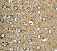ab92313, at 1/100 dilution, staining RHEB in paraffin-embedded Human brain tissue, by Immunohistochemistry.