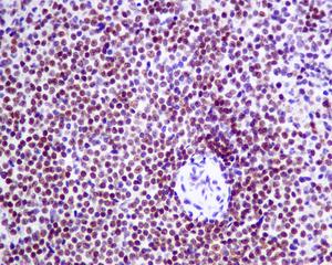 Immunohistochemical analysis of paraffin-embedded Human spleen tissue labelling NSMCE1 with ab139689 at 1/50 dilution.