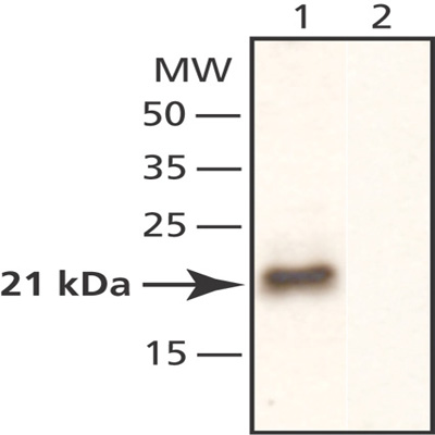 All lanes : Anti-RhoA antibody (ab50540) at 1/2000 dilutionLane 1 : Cell lysate of HEK-293 cells transfected with human RhoALane 2 : Cell lysate of HEK-293 cells transfected with human RhoA with 20 µg/mL immunizing peptide SecondaryHRP Goat Anti-Rabbit IgGdeveloped using the ECL technique