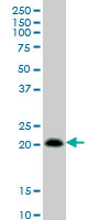 RHOC antibody (ab54837) at 1ug/lane + Jurkat cell lysate at 25ug/lane.