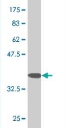 Anti-RHOG antibody [2E6] (ab76508) at 1/500 dilution + immunogen at 0.2 µgSecondaryGoat Anti-Mouse IgG (H&L)-HRP Conjugate at 1/5000 dilution