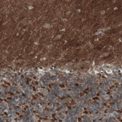 Immunohistochemical analysis of paraffin-embedded Human cerebellum tissue, labeling Rhot1 using ab188029 at a 1/200 dilution.