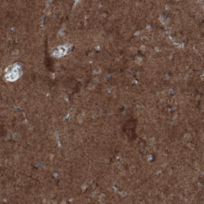 Immunohistochemical analysis of paraffin-embedded Human cerebral cortex tissue, labeling Rhot1 using ab188029 at a 1/200 dilution.