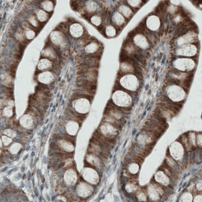 Immunohistochemical analysis of paraffin-embedded Human small intestine tissue, labeling Rhot1 using ab188029 at a 1/200 dilution.