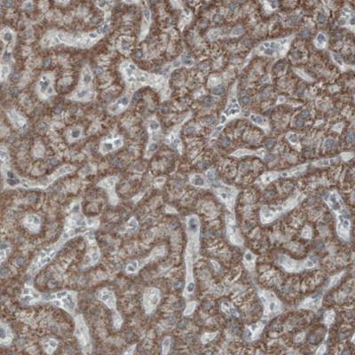 Immunohistochemical analysis of paraffin-embedded Human liver tissue, labeling Rhot1 using ab188029 at a 1/200 dilution.