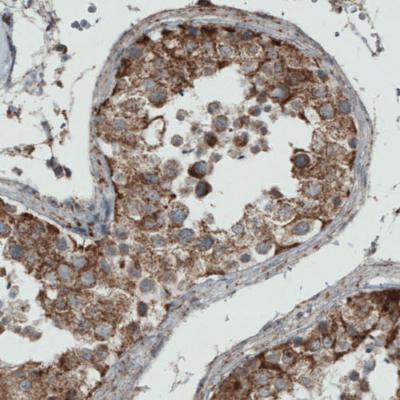 Immunohistochemical analysis of paraffin-embedded Human testis tissue, labeling Rhot1 using ab188029 at a 1/200 dilution.