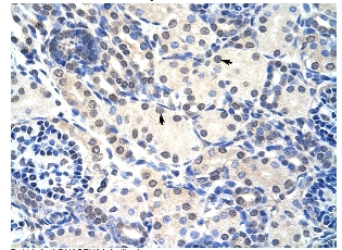 Immunohistochemistry (Formalin/PFA-fixed paraffin-embedded sections) analysis of human kidney tissue labelling Ribonuclease H2 with ab55990 at 4-8ug/ml. Arrows indicate positively labeled epithelial cells of the renal tubule. Magnification: 400X.