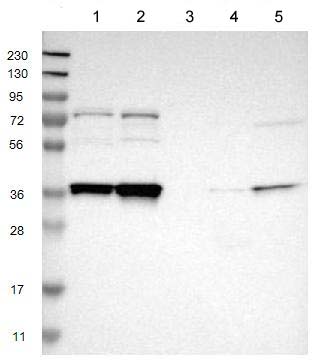 All lanes : Anti-NSRP1 antibody (ab121478) at 1/250 dilutionLane 1 : RT 4 lysate Lane 2 : U 251 MG lysateLane 3 : Human Plasma lysate Lane 4 : Human liver lysate Lane 5 : Human tonsil lysatedeveloped using the ECL technique