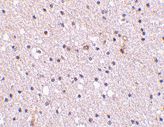 ab45425 at 2.5 µg/ml staining Nicastrin in human brain tissue section by Immunohistochemistry (Formalin/ PFA fixed paraffin-embedded tissue sections).