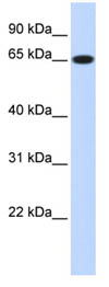 Anti-Ribophorin I antibody (ab86267) at 1 µg/ml + Transfected 293T cell lysate at 10 µgSecondaryanti-Rabbit IgG HRP at 1/50000 dilution