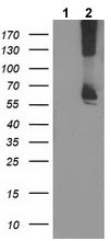 All lanes : Anti-Ribophorin I antibody [3E1] (ab123904) at 1/500 dilutionLane 1 : HEK293T cell lysate transfected with pCMV6-ENTRY controlLane 2 : HEK293T cell lysate transfected with pCMV6-ENTRY Ribophorin I cDNALysates/proteins at 5 µg per lane.