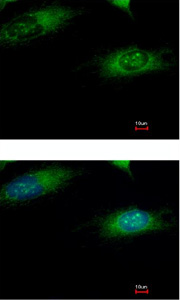 Immunofluorescence analysis of methanol-fixed HeLa cells labelling Ribophorin 1 with ab137668 at 1/500 dilution. Lower panel is costained with Hoechst 33342.