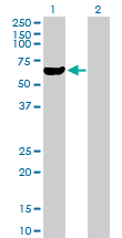 All lanes : Anti-Ribophorin II antibody (ab88663) at 1 µg/mlLane 1 : Ribophorin II transfected 293T cell lysate Lane 2 : Non transfected 293T cell lysate Lysates/proteins at 25 µg per lane.