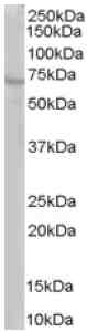Anti-RIC8 antibody (ab24383) at 1 µg/ml + Human Brain lysate (RIPA buffer, 35µg total protein per lane).