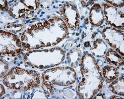 ab118 at 1/50 dilution staining RIC8A in Paraffin-embedded Human kidney tissue by Immunohistochemistry.