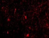 Immunofluorescence of Nicastrin in Human Brain cells using ab45425 at 20 ug/ml.