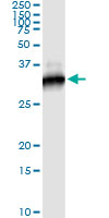 ab128042 staining RICTOR in RICTOR transfected cell lysate immunoprecipitated using anti-RICTOR monoclonal antibody and Protein A Magnetic Bead.