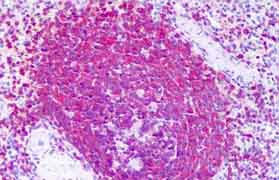 ab128042, at a concentration of 5 µg/ml, staining RICTOR in paraffin-embedded Human spleen tissue by Immunohistochemistry.