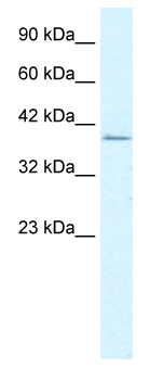 Anti-RIMS3 antibody (ab50198) at 1.25 µg/ml + Jurkat cell lysate at 10 µgSecondaryHRP conjugated anti-Rabbit IgG at 1/50000 dilution