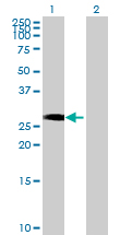 All lanes : Anti-RING finger protein unkempt like antibody (ab68731) at 1/500 dilutionLane 1 : RING finger protein unkempt like transfected 293T cell lysateLane 2 : Non transfected 293T cell lysateLysates/proteins at 25 µg per lane.SecondaryGoat Anti-Mouse IgG (H&L)-HRP Conjugate at 1/2500 dilution