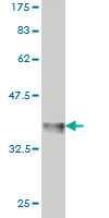 Western blot against tagged recombinant protein immunogen using ab57985 RING1 antibody at 1ug/ml.