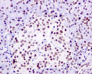 Immunohistochemical analysis of paraffin-embedded Human pancreas tissue labeling RING1 using ab180170 at 1/50 dilution.