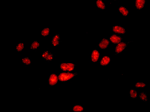 Immunofluorescence analysis of HeLa cells labeling RING1 using ab180170 at 1/50 dilution.