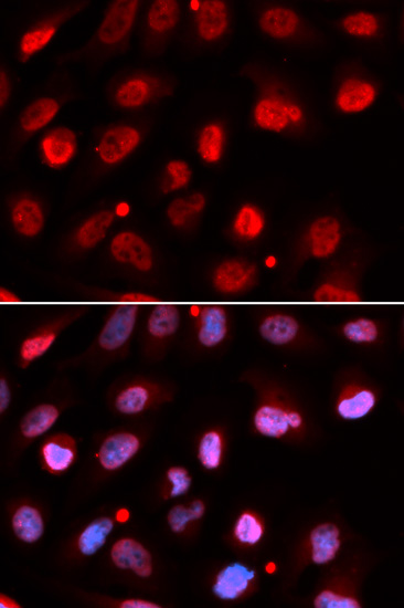 Immunocytochemistry/Immunofluorescence analysis of U2OS cells using ab187509. Blue DAPI for nuclear staining.