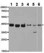 All lanes : Anti-RING2 / RING1B / RNF2 antibody (ab187509) at 1/500 dilutionLane 1 : 293T extractLane 2 : Jurkat extractLane 3 : U937 extractLane 4 : SH-SYSY extractLane 5 : 22RV-1 extractLane 6 : Mouse testis extract