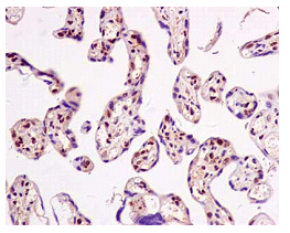 Immunohistochemical analysis of paraffin-embedded Human placenta tissue labeling RING2 / RING1B / RNF2 with ab181140 at 1/500 dilution followed by pre-diluted HRP-conjugated secondary antibody and counter-stained with Hematoxylin.