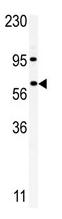 Anti-RIOK1 antibody - Carboxyterminal end (ab71524) at 1/100 dilution + A375 cell line lysate at 12.5 µg