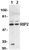 All lanes : Anti-RIP2 antibody (ab8428) at 1/1000 dilutionLane 1 : A431 whole cell lysateLane 2 : K562 whole cell lysateObserved band size : 60 kDa (why is the actual band size different from the predicted?)