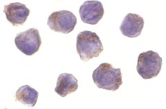 ab8428 at 10µg/ml staining RIP2 in A431 cells by ICC/IF